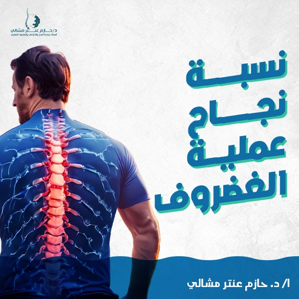 نسبة نجاح عملية الغضروف عالية