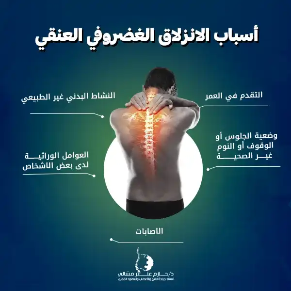 أسباب الانزلاق الغضروفي العنقي