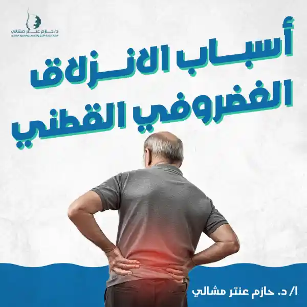 5 أسباب الانزلاق الغضروفي القطني