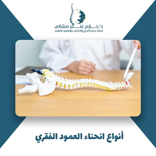 أنواع انحناء العمود الفقري أنواع انحناء العمود الفقري