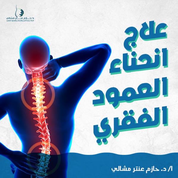 علاج انحناء العمود الفقري