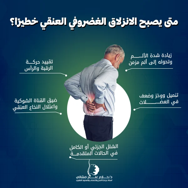 متى يصبح الانزلاق الغضروفي العنقي خطيرًا؟