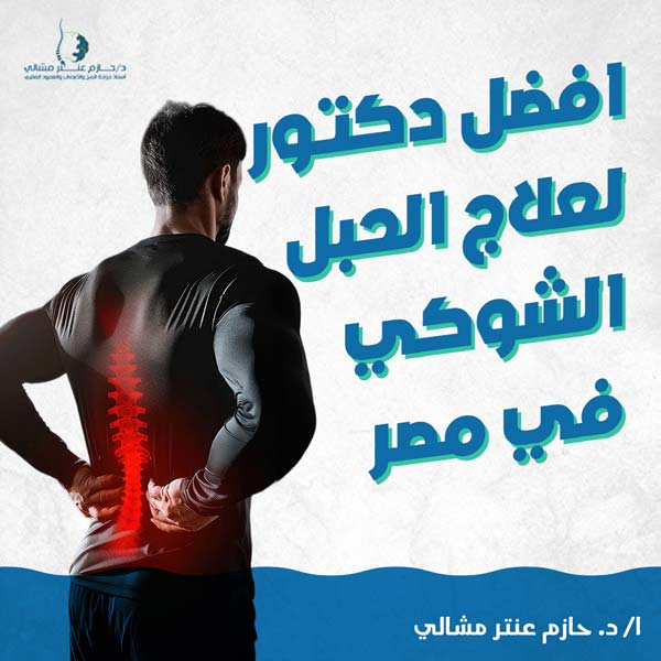 افضل دكتور لعلاج الحبل الشوكي في مصر