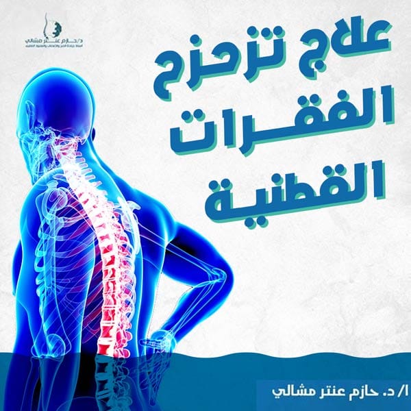 علاج تزحزح الفقرات القطنية