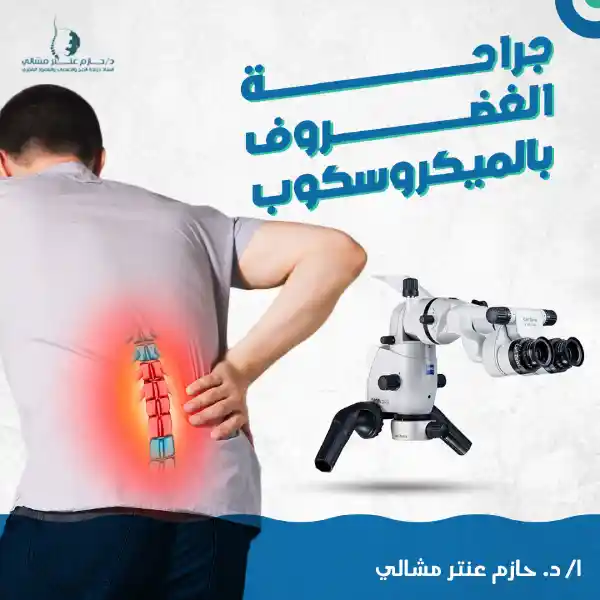 جراحة الغضروف بالميكروسكوب