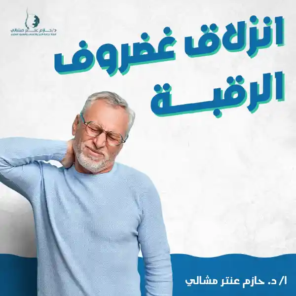 انزلاق غضروف الرقبة