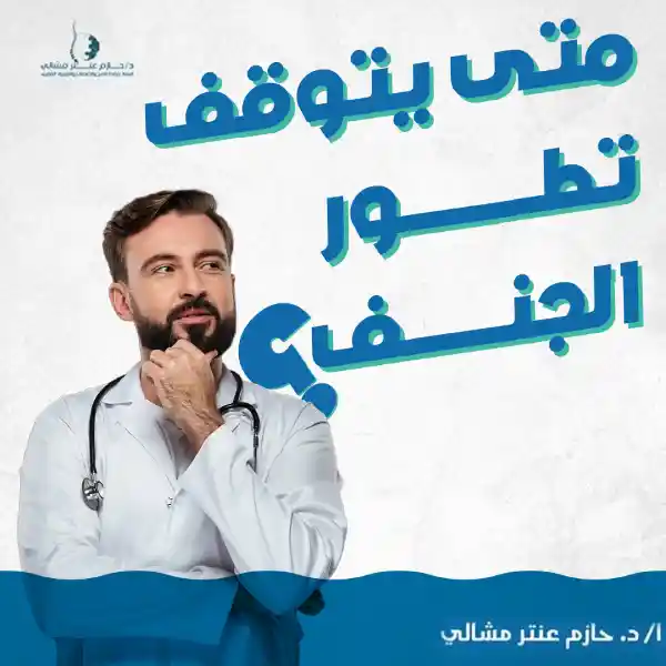 متى يتوقف تطور الجنف؟