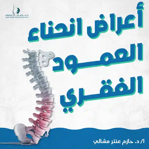 أعراض انحناء العمود الفقري