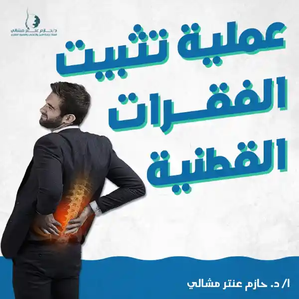 عملية تثبيت الفقرات القطنية